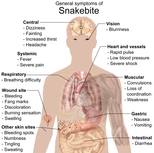 Snake bite symptoms